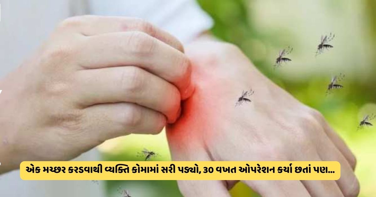 mosquito bites